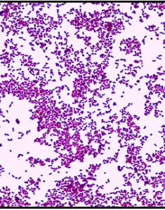 Gram-stained-Enteroccoci-by-Gram-stain-Enteroccoci-appear-as-Gram-positive-diplococci
